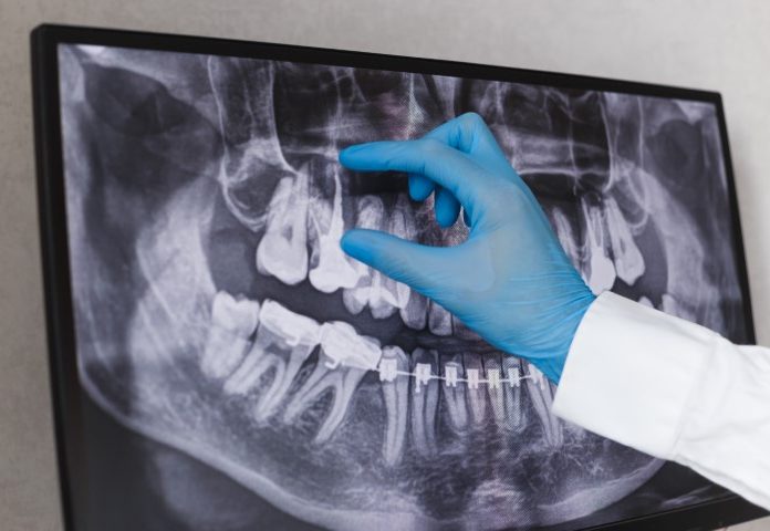 Sameh Aknouk - Digital X-Ray